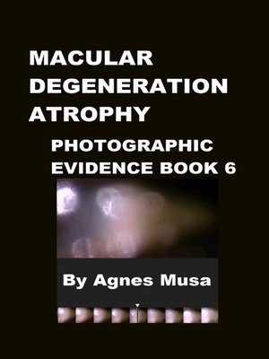 cover image of Macular Degeneration Atrophy, Photographic Evidence Book 6